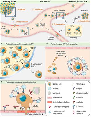 The Role of Platelet Cell Surface P-Selectin for the Direct Platelet-Tumor Cell Contact During Metastasis Formation in Human Tumors